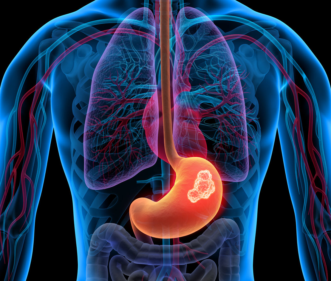 Gastrointestinal & GI onco surgeon in mumbai