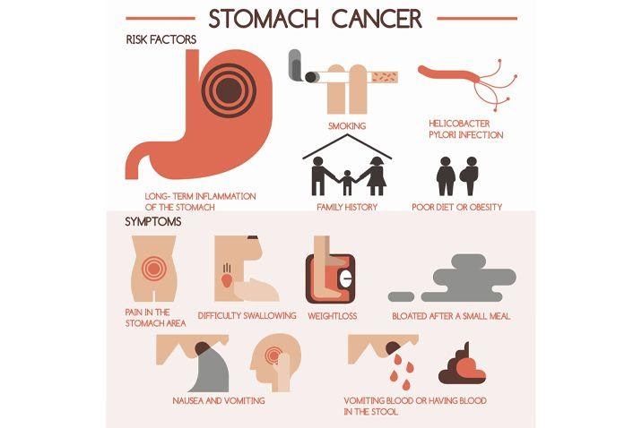 Stomach Cancer
