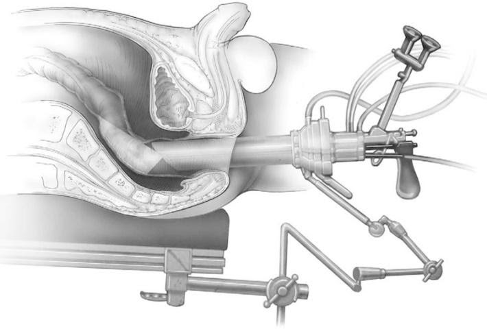 GI and Colorectal Cancer
